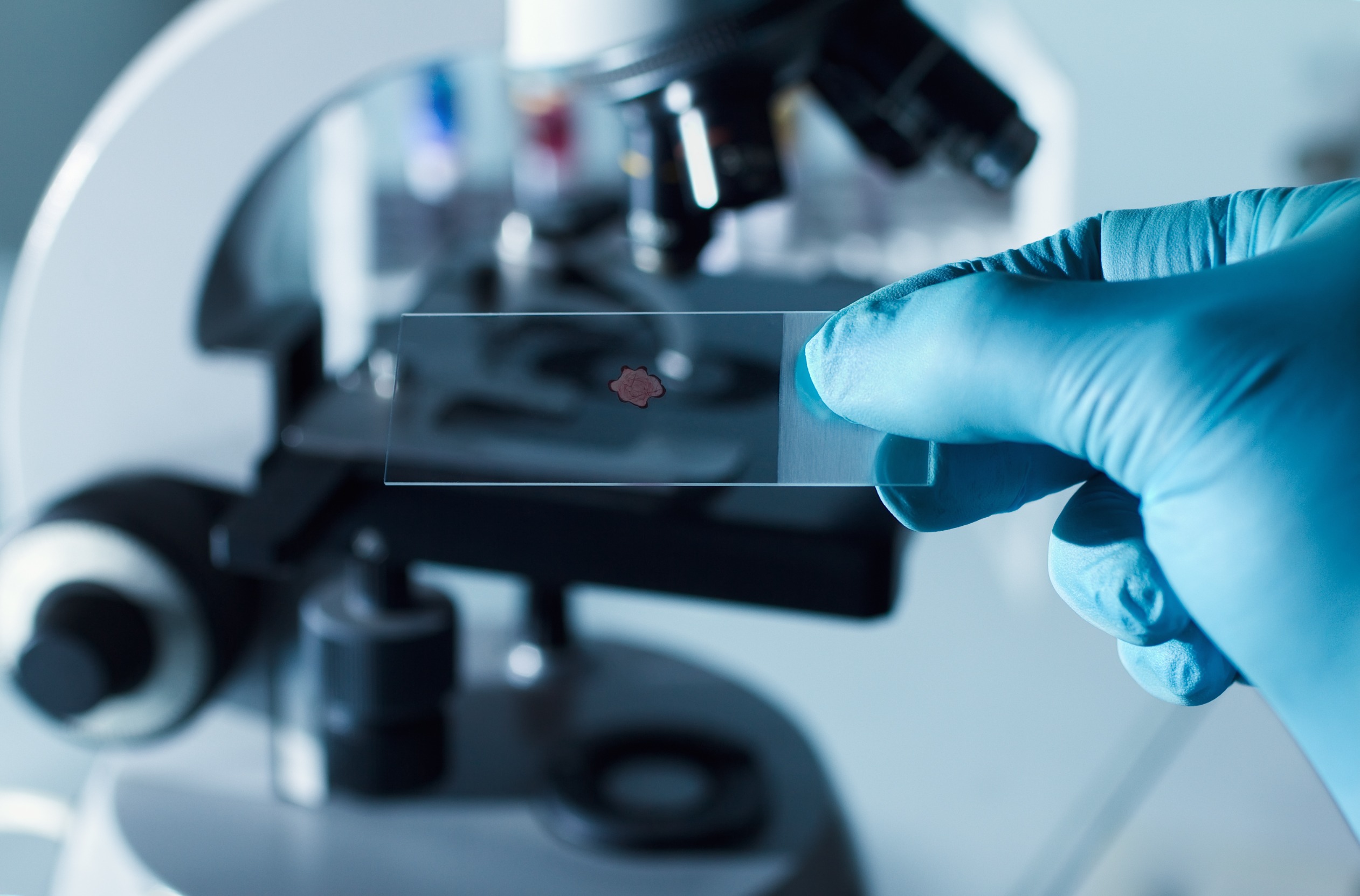 Anavex Life Sciences (AVXL) Reports Net Loss of $10.1M in Q4